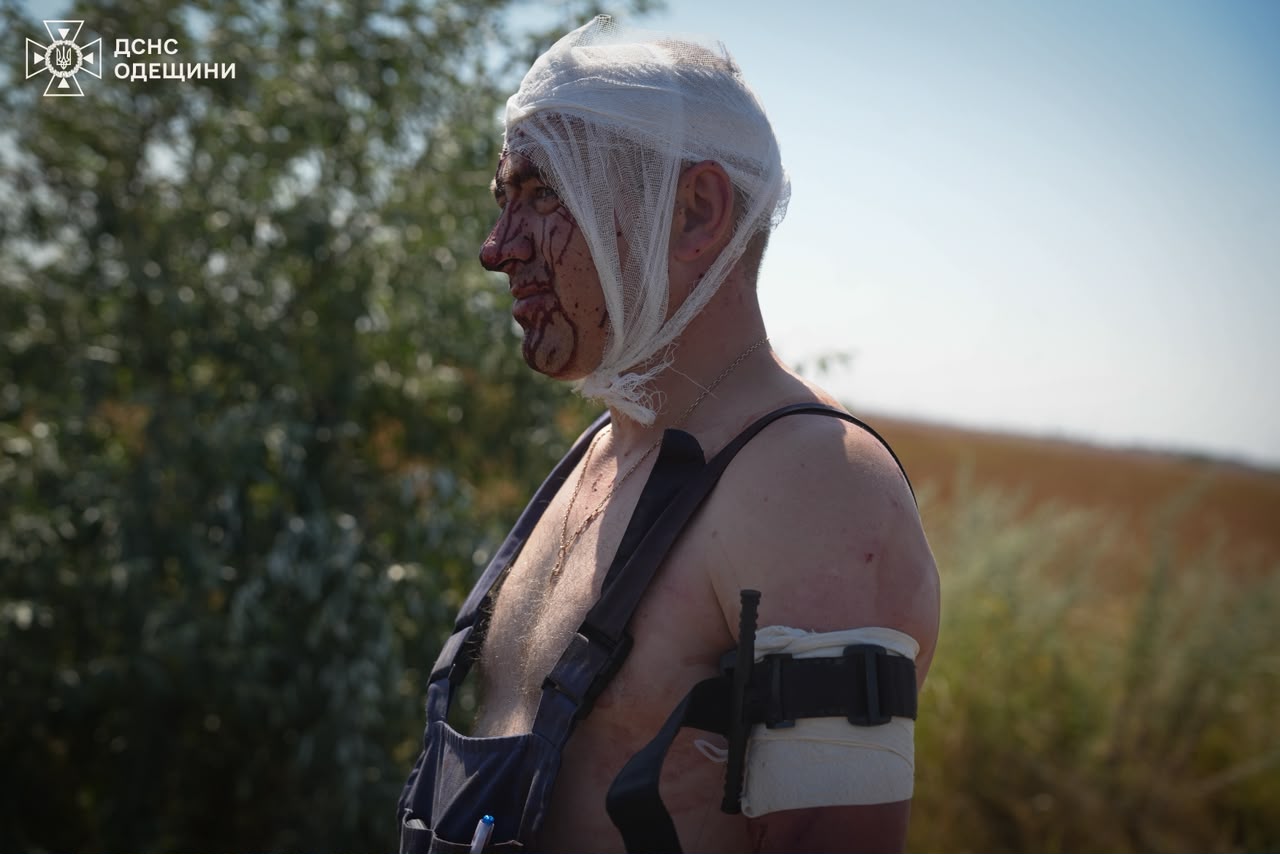 Одещина під ворожим вогнем: постраждали 4 особи